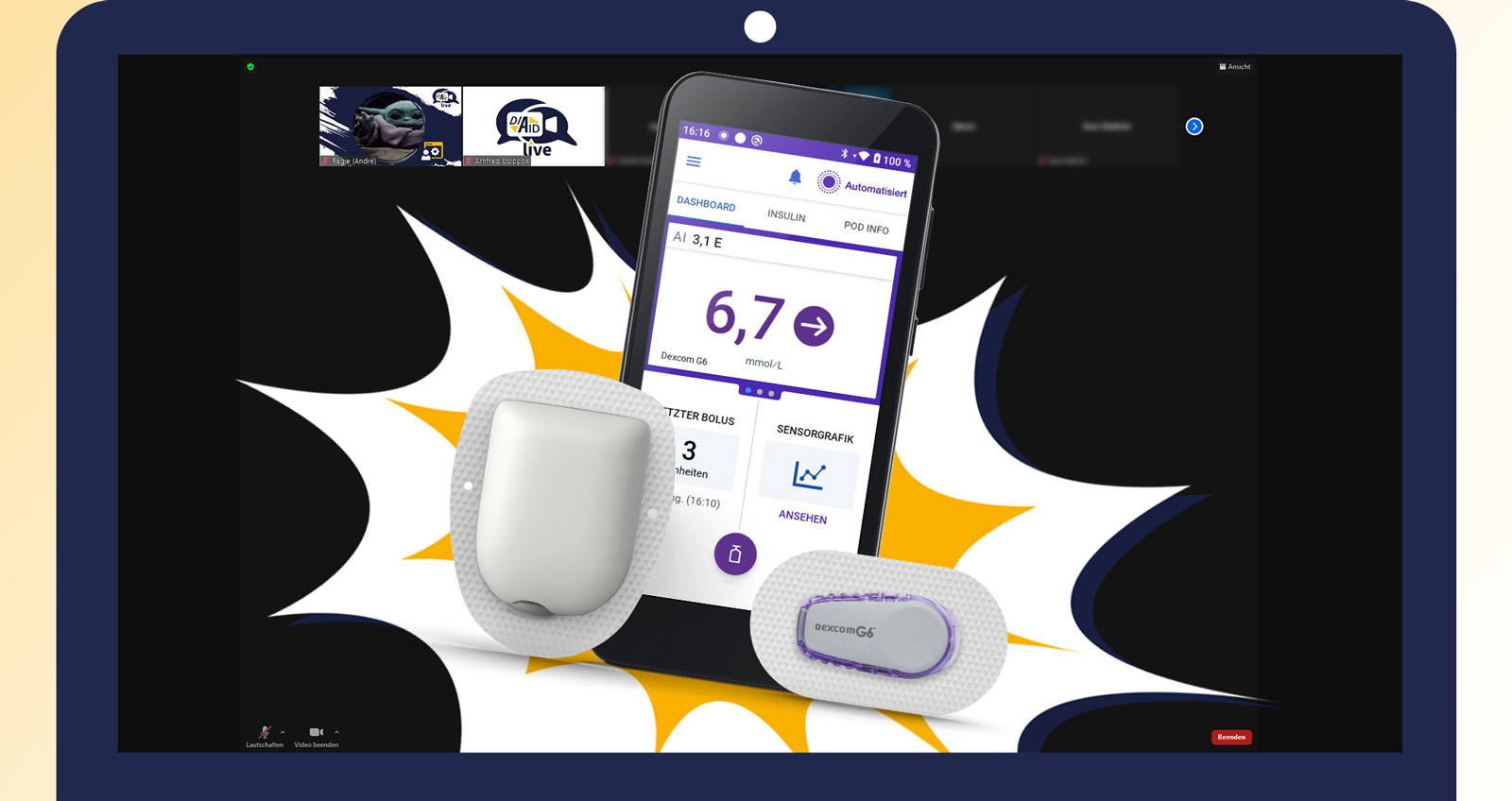 Eine Videokonferenz in der das Omnipod 5-System zu sehen ist