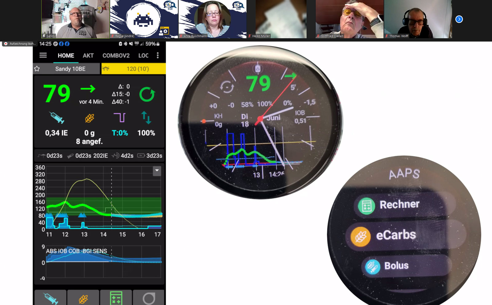 AAPS auf der Smartwatch