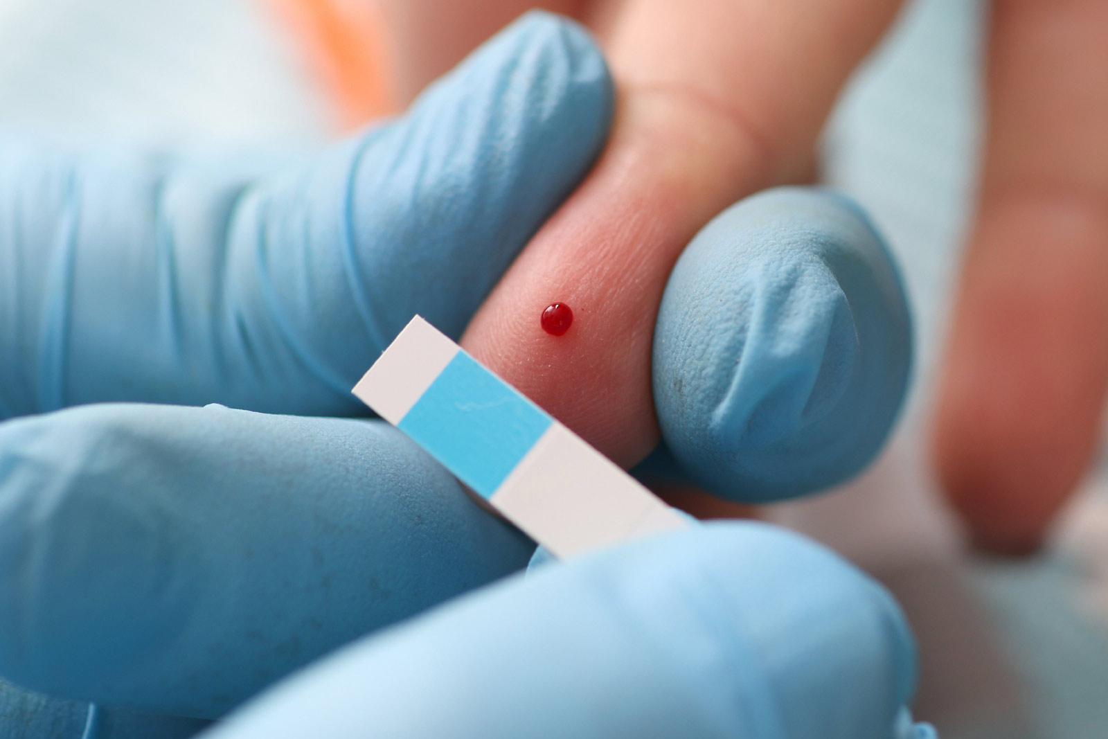 Blutzuckermessung Ein Piks in cden Finger zur Bestimmung des Blutzuckers